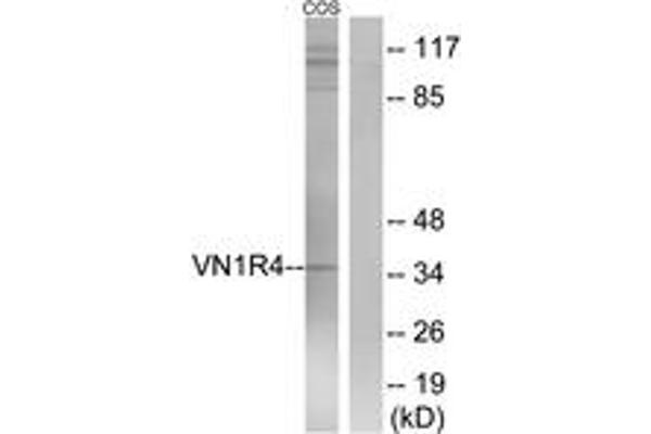 VN1R4 anticorps  (AA 88-137)