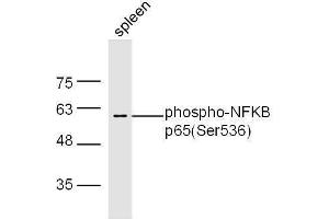 Western Blotting (WB) image for anti-Nuclear Factor-kB p65 (NFkBP65) (pSer536) antibody (ABIN730528)