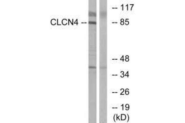 CLCN4 anticorps
