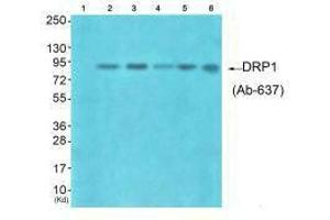 Western blot analysis of extracts from HuvEc cells (Lane 2), HepG2 cells (Lane 3), colo cells (Lane 4), 293 cells (Lane 5) and JK cells (Lane 6), using DRP1 (Ab-637) antiobdy. (Dynamin 1-Like anticorps  (C-Term))