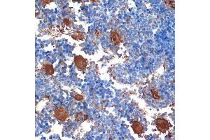 Immunohistochemistry of paraffin-embedded mouse bone marrow using CXCL4/CXCL4/PF4 Rabbit mAb (ABIN1683188, ABIN3017983, ABIN3017984 and ABIN7101555) at dilution of 1:100 (40x lens). (PF4 anticorps)