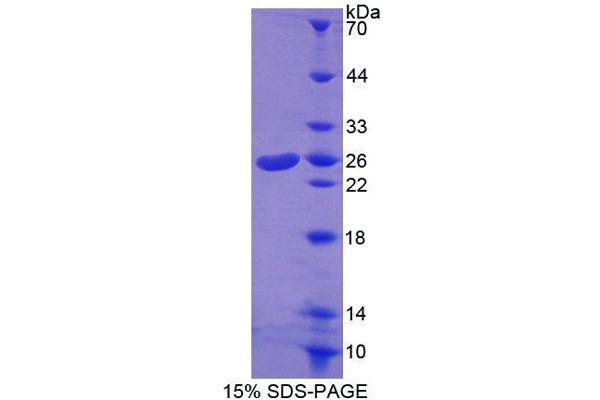 ABCA8 Protein (AA 1263-1456) (T7 tag,His tag)