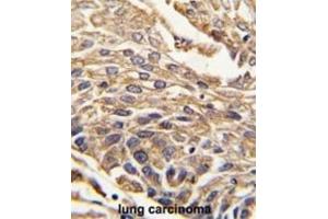 Immunohistochemistry (IHC) image for anti-Arylsulfatase B (ARSB) antibody (ABIN3003229) (Arylsulfatase B anticorps)