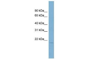 Coactosin-Like 1 antibody used at 1 ug/ml to detect target protein. (COTL1 anticorps)