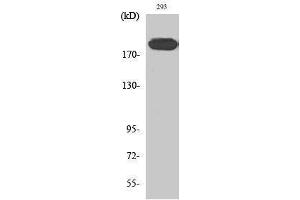 Western Blotting (WB) image for anti-Insulin Receptor Substrate 1 (IRS1) (Ser62) antibody (ABIN3175713) (IRS1 anticorps  (Ser62))