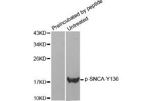 Western Blotting (WB) image for anti-Synuclein, alpha (SNCA) (pTyr136) antibody (ABIN1870623) (SNCA anticorps  (pTyr136))