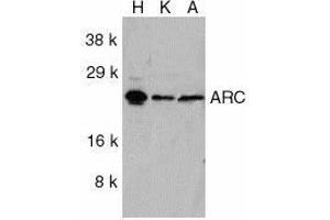 Western blot analysis of ARC in HeLa (H), KB (K), and A549 (A) whole cell lysates with ARC antibody at 1ug/ml. (NOL3 anticorps  (C-Term))