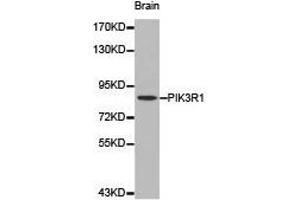 Western Blotting (WB) image for anti-Phosphoinositide 3 Kinase, p85 alpha (PI3K p85a) antibody (ABIN1874135) (PIK3R1 anticorps)