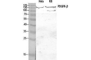 Western Blotting (WB) image for anti-Platelet Derived Growth Factor Receptor beta (PDGFRB) (Thr215) antibody (ABIN3186370) (PDGFRB anticorps  (Thr215))