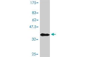 Western Blot detection against Immunogen (37. (AKT1 anticorps  (AA 381-480))