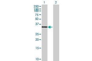 Lane 1: AURKC transfected lysate ( 34. (AURKC 293T Cell Transient Overexpression Lysate(Denatured))