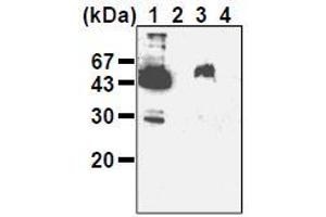 Western Blotting (WB) image for anti-Podoplanin (PDPN) antibody (ABIN1449217)