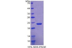 SDS-PAGE (SDS) image for Coagulation Factor II (thrombin) (F2) (AA 44-198) protein (His tag) (ABIN1877316) (Prothrombin Protein (AA 44-198) (His tag))