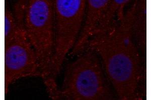 Immunofluorescence staining of methanol-fixed Hela cells, using Phospho-SNCA-Y133 antibody. (SNCA anticorps  (pTyr133))