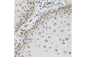 Immunohistochemistry of paraffin-embedded human esophagus using TGM2 antibody (ABIN5970369) (40x lens). (Transglutaminase 2 anticorps)