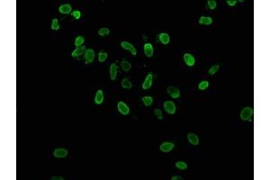 Immunofluorescence staining of Hela cells with ABIN7139179 at 1:37. (HIST1H3A anticorps  (acLys36))