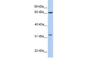 PBK antibody used at 1 ug/ml to detect target protein. (PBK anticorps  (N-Term))