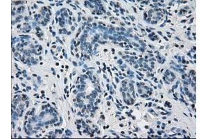 Immunohistochemical staining of paraffin-embedded breast tissue using anti-PPP5C mouse monoclonal antibody. (PP5 anticorps)