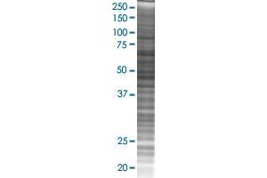 CCT6B transfected lysate. (CCT6B 293T Cell Transient Overexpression Lysate(Denatured))