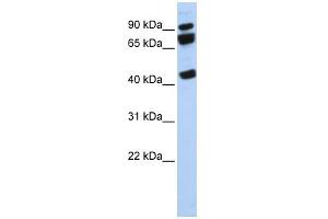 WB Suggested Anti-DDX17 Antibody Titration:  0. (DDX17 anticorps  (N-Term))