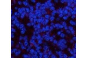 Immunofluorescence analysis of Mouse spleen tissue using PDGFRA Monoclonal Antibody at dilution of 1:200. (PDGFRA anticorps)