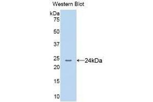 Detection of Recombinant AGR2, Human using Monoclonal Antibody to Anterior Gradient 2 (AGR2) (AGR2 anticorps  (AA 21-175))