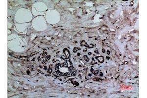 Immunohistochemistry (IHC) analysis of paraffin-embedded Human Breast, antibody was diluted at 1:100. (Histone 3 anticorps  (meLys37))