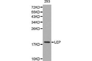Western Blotting (WB) image for anti-Leptin (LEP) (AA 22-167) antibody (ABIN6216821) (Leptin anticorps  (AA 22-167))
