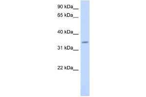 PAQR6 antibody used at 1 ug/ml to detect target protein. (PAQR6 anticorps  (Middle Region))