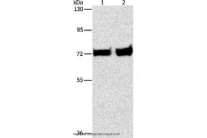 Western blot analysis of Mouse liver and kidney tissue, using PCK1 Polyclonal Antibody at dilution of 1:375 (PCK1 anticorps)