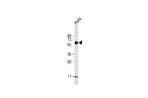 Anti-SMOC1 Antibody (C-term) at 1:2000 dilution + Hela whole cell lysate Lysates/proteins at 20 μg per lane. (SMOC1 anticorps  (C-Term))