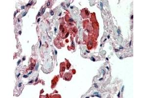 IHC staining of FFPE human lung with IDE antibody at 2. (IDE anticorps)