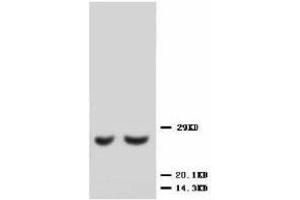 Image no. 1 for anti-Metalloproteinase Inhibitor 2 (TIMP2) (C-Term) antibody (ABIN1493035) (TIMP2 anticorps  (C-Term))