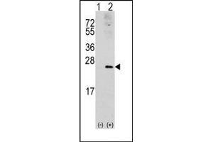 Western blot analysis of RAC1 (arrow) using rabbit polyclonal RAC1 Antibody. (RAC1 anticorps  (Ser71))