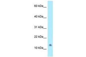 Image no. 1 for anti-N-Acetyltransferase 8-Like (GCN5-Related, Putative) (NAT8L) (C-Term) antibody (ABIN6747980) (NAT8L anticorps  (C-Term))