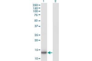 Western Blot analysis of IL2 expression in transfected 293T cell line by IL2 monoclonal antibody (M11), clone 1C5. (IL-2 anticorps  (AA 21-153))