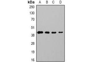 Western blot analysis of GAP43 expression in Hela (A), 293T (B), mouse brain (C), rat brain (D) whole cell lysates. (GAP43 anticorps)