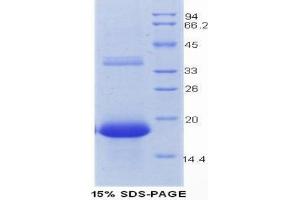 SDS-PAGE analysis of Mouse REG3G Protein. (REG3g Protéine)