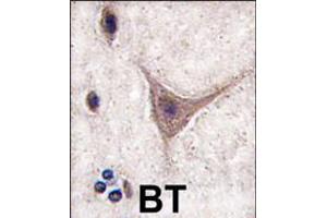 Formalin-fixed and paraffin-embedded human brain tissue reacted with CDH10 antibody , which was peroxidase-conjugated to the secondary antibody, followed by DAB staining. (CDH10 anticorps  (C-Term))