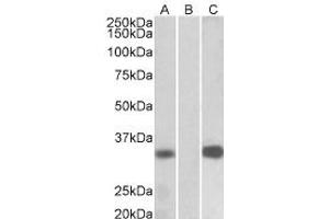 Western Blotting (WB) image for anti-Kv Channel Interacting Protein 3, Calsenilin (KCNIP3) (Internal Region) antibody (ABIN2465100) (DREAM anticorps  (Internal Region))