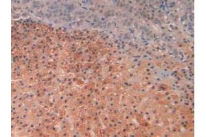 IHC-P analysis of Rat Adrenal Gland Tissue, with DAB staining. (SLIT1 anticorps  (AA 308-512))