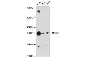 Western blot analysis of extracts of various cell lines, using NPHS2 antibody (ABIN1680543, ABIN7101468, ABIN7101469 and ABIN7101470) at 1:1000 dilution. (Podocin anticorps)