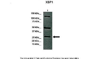 Lanes:   Lane 1: 40ug whole canine retina  Primary Antibody Dilution:   1:1000  Secondary Antibody:   Anti-rabbit-HRP  Secondary Antibody Dilution:   1:5000  Gene Name:   XBP1 a  Submitted by:   Dr. (XBP1 anticorps  (C-Term))