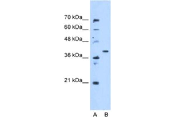 ECHDC3 anticorps