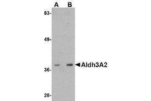 Image no. 1 for anti-Aldehyde Dehydrogenase 3 Family, Member A2 (ALDH3A2) (C-Term) antibody (ABIN342713) (ALDH3A2 anticorps  (C-Term))