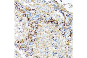 Immunohistochemistry of paraffin-embedded mouse testis using eIF2A Rabbit mAb (ABIN7267035) at dilution of 1:100 (40x lens). (EIF2A anticorps)
