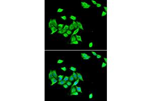 Immunofluorescence analysis of A549 cells using DNMT3A antibody (ABIN5973891). (DNMT3A anticorps)