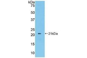 Detection of Recombinant PROS, Human using Polyclonal Antibody to Protein S (PROS) (PROS1 anticorps  (AA 481-667))