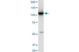 HK2 monoclonal antibody (M01), clone 4H1. (Hexokinase 2 anticorps  (AA 818-917))