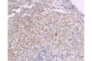 Immunohistochemistry (Paraffin-embedded Sections) (IHC (p)) image for anti-Cyclin D2 (CCND2) (AA 161-288) antibody (ABIN738366)